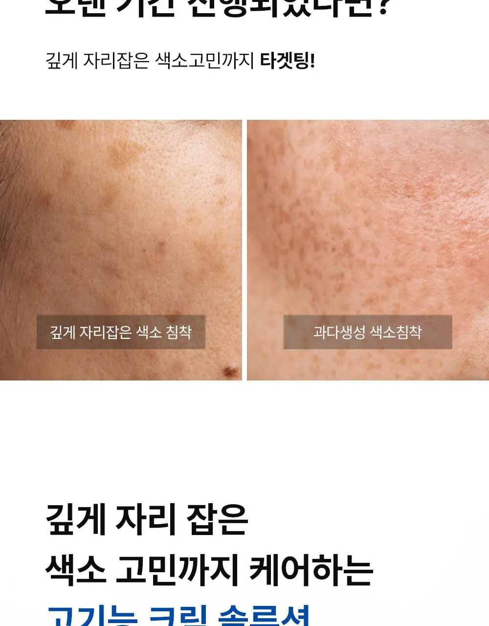 [단독기획] 동아제약 색소침착 프로 크림제 40ml 기획(+5ml*2) 상세페이지 8